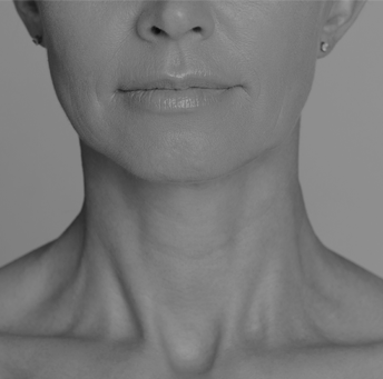 Treatment - Harrow Dental