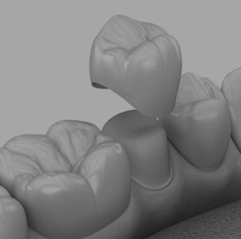 Treatment - Harrow On The Hill Dental and Facial Aesthetics